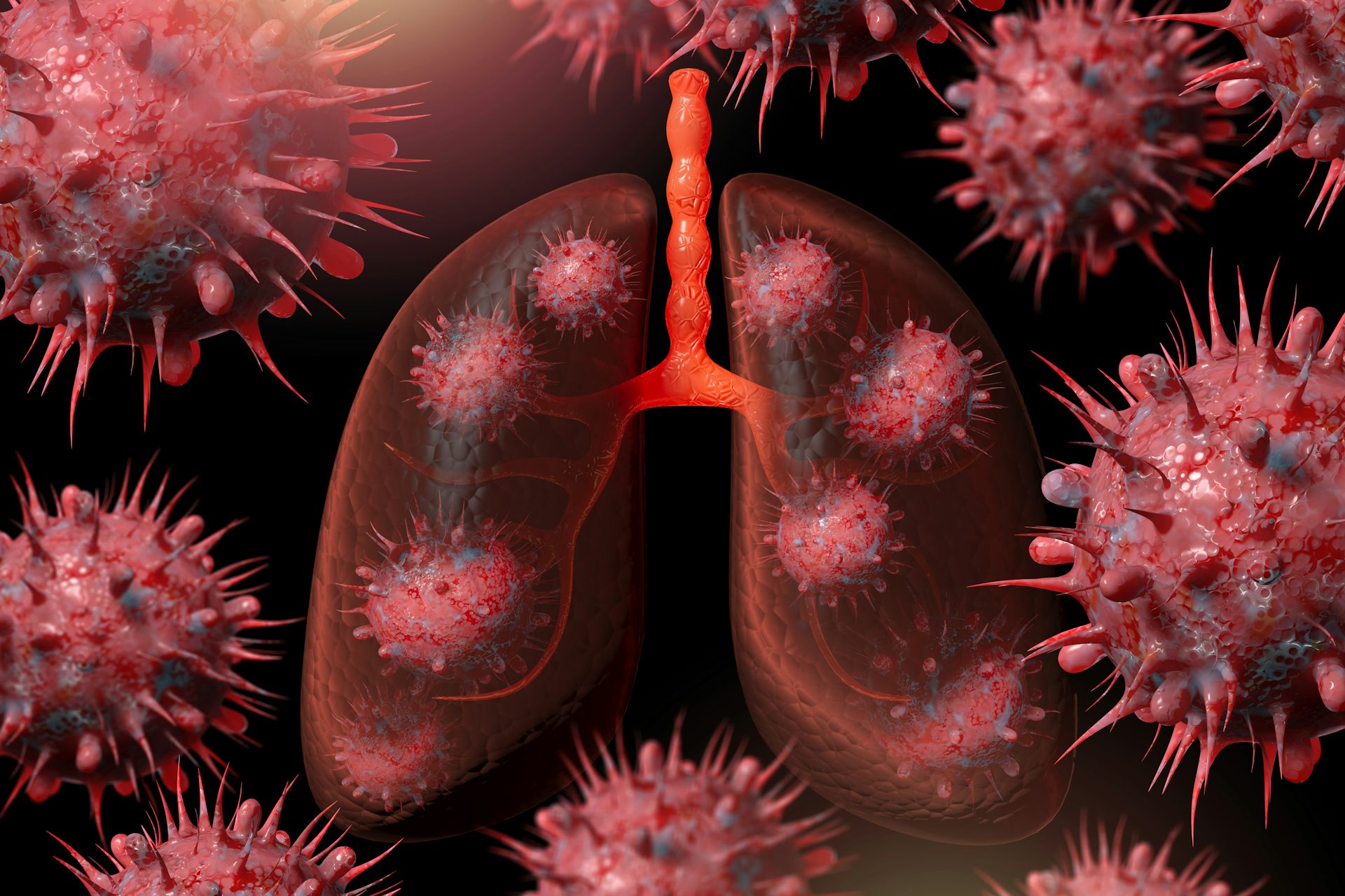 Computer-generated image of coronavirus inside lungs surrounded by multiple copies of the virus.