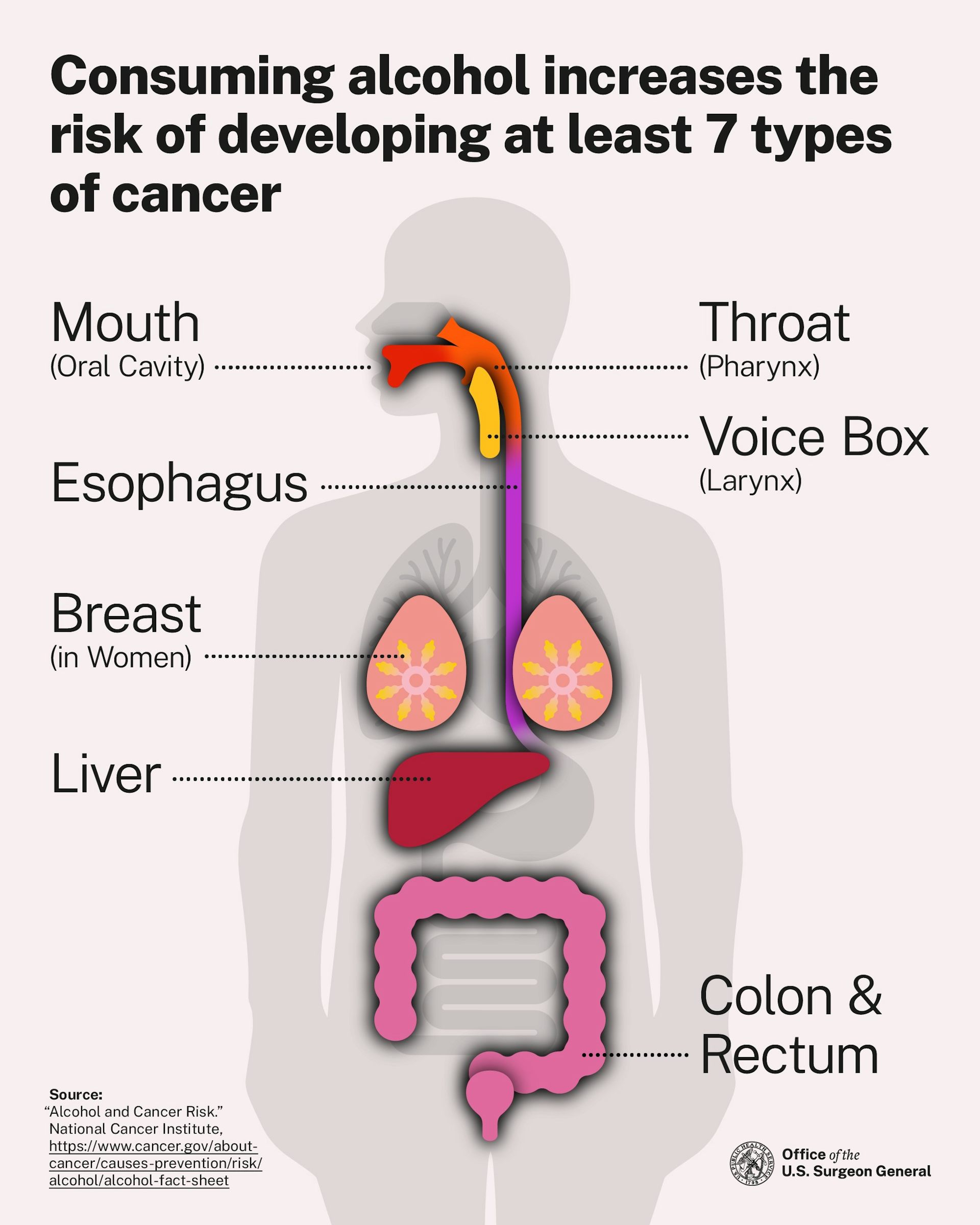 A diagram of the human body showing the seven types of cancer caused by drinking.